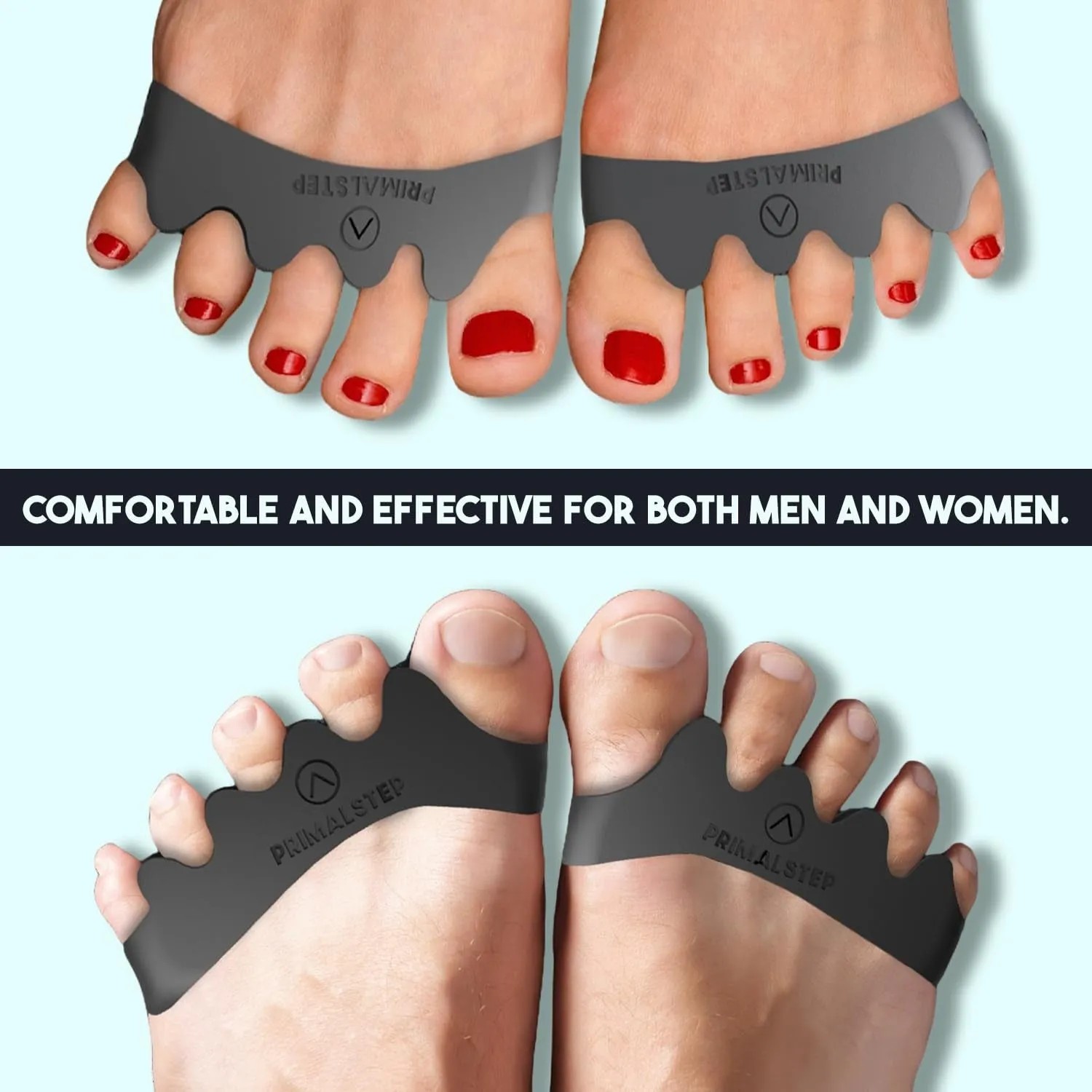 Size XL Toe Separators - over 50% Thicker & More Durable - Dr. Recommended - Correct Foot, Bunion Pain, Plantar Fasciitis - Toe Straightener for Functional Athletic Mobility (Extra Large)