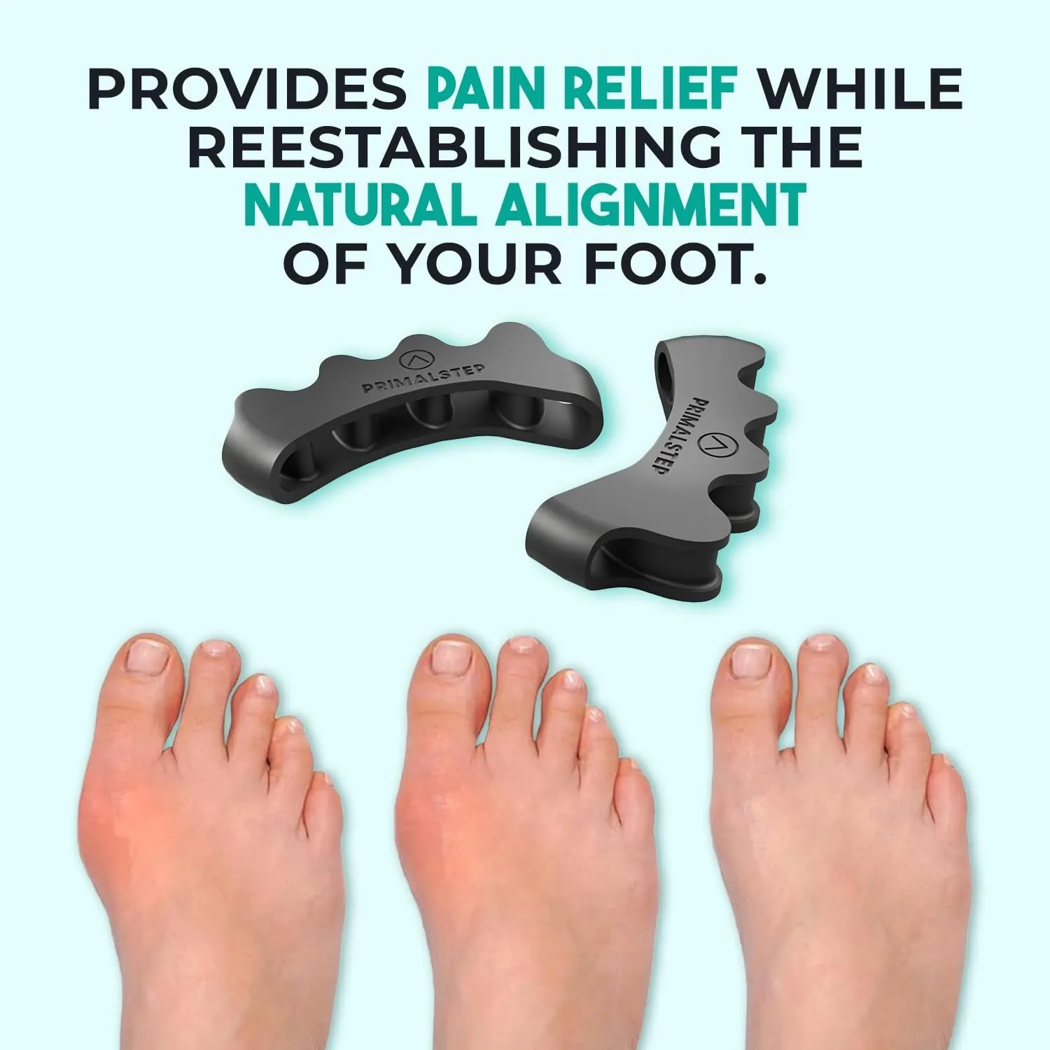 Size XL Toe Separators - over 50% Thicker & More Durable - Dr. Recommended - Correct Foot, Bunion Pain, Plantar Fasciitis - Toe Straightener for Functional Athletic Mobility (Extra Large)